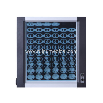 Professional Medical Led Film Viewer X-Ray View Box